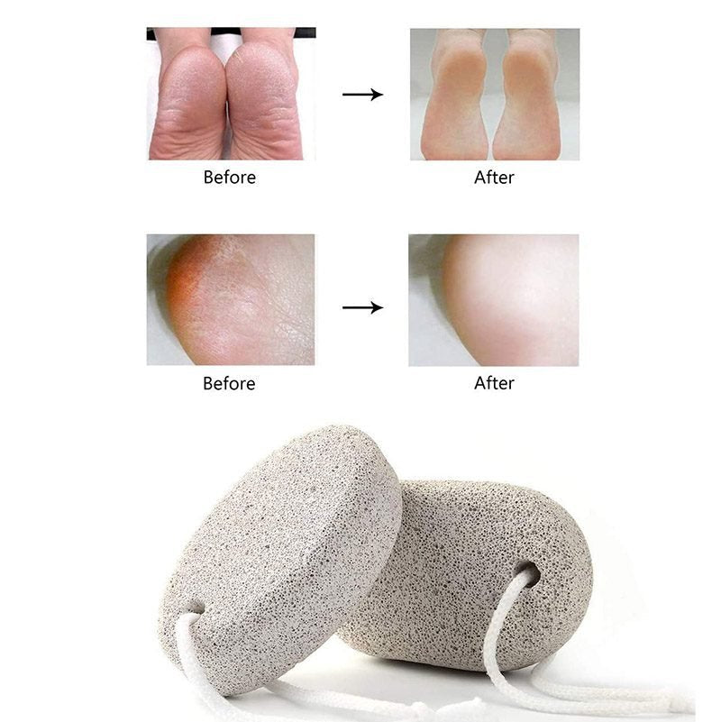 Luxury Foot Pumice Stone – Imported Material, Two Practical Shapes